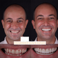 InstaVeneers™ - Transform Your Smile Instantly! (LAST DAY 50% OFF)